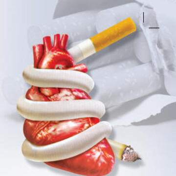 التدخين يزيد مخاطر الإصابة بسرطان القولون والمستقيم